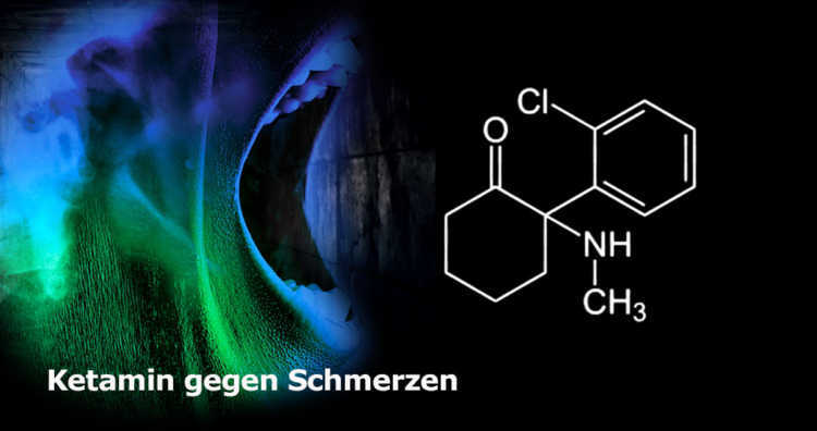 Ketamin gegen Schmerzen